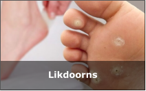 Likdoorns